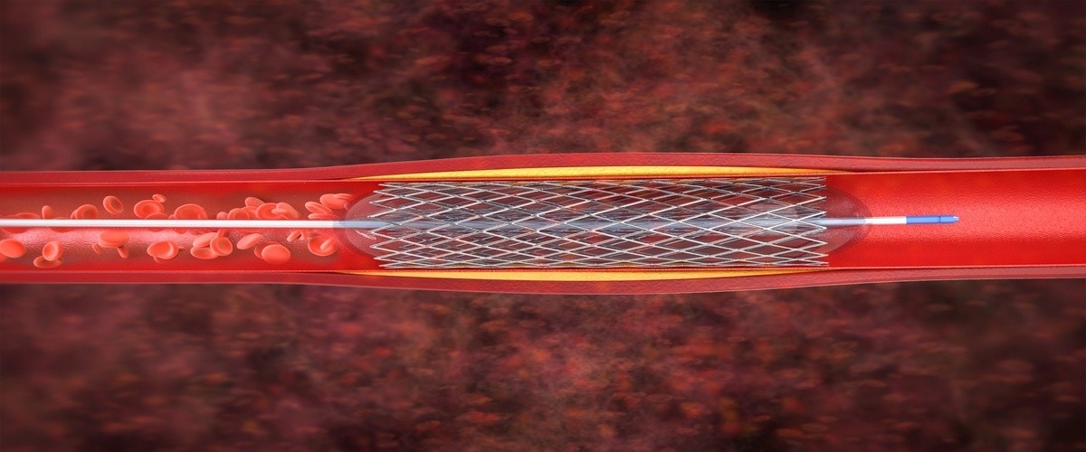 Robotic surgery hospital Adyar