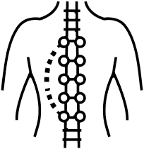 Scoliosis Treatment