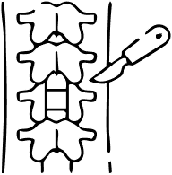 Disc Replacement Specialist