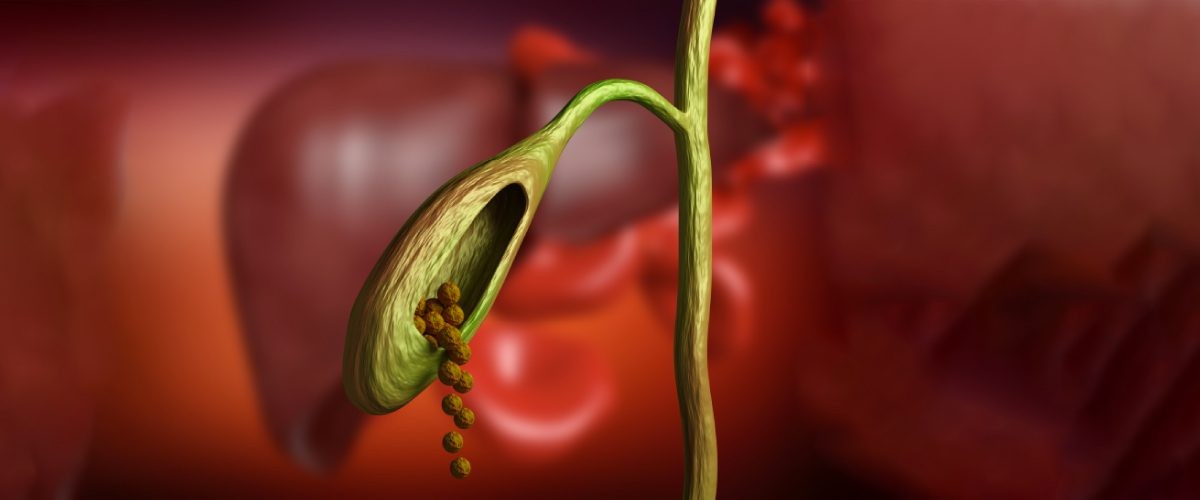 Robotic surgery hospital Adyar